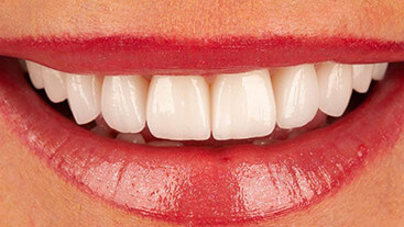 Cosmetic Dentistry Service Image