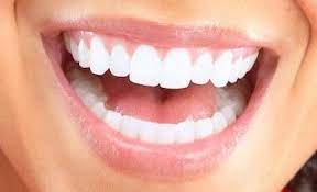Zirconia Dental Implants Service Image